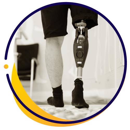 cagnotte Prothèse orthopédique